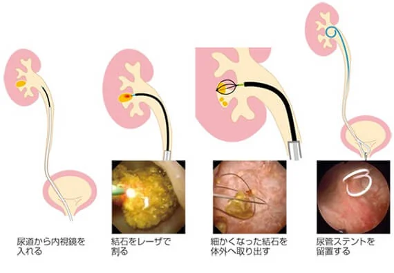 ボストン勃起不全クリニック